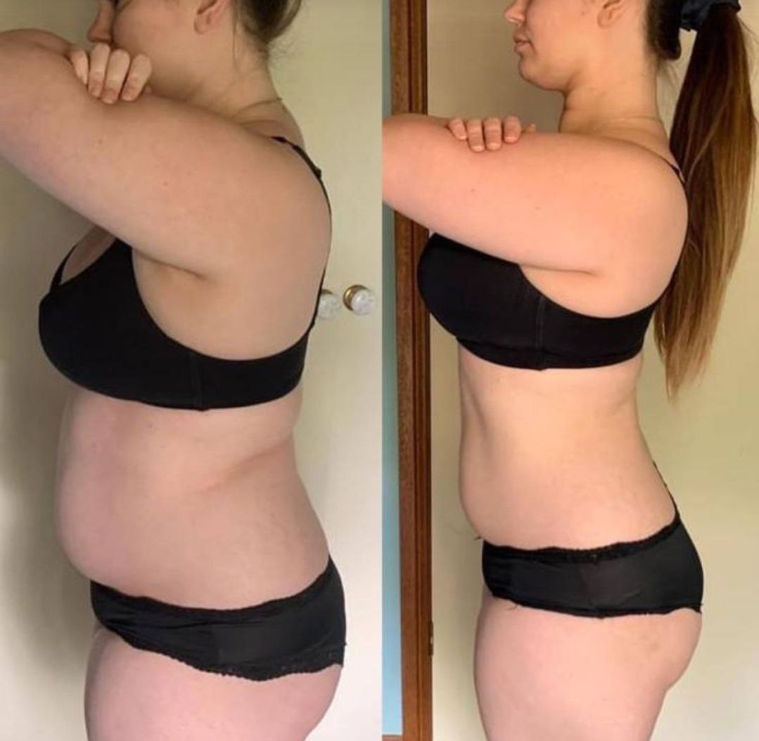 Understanding Weight Gain and How to Manage It for Healthy Weight Loss
